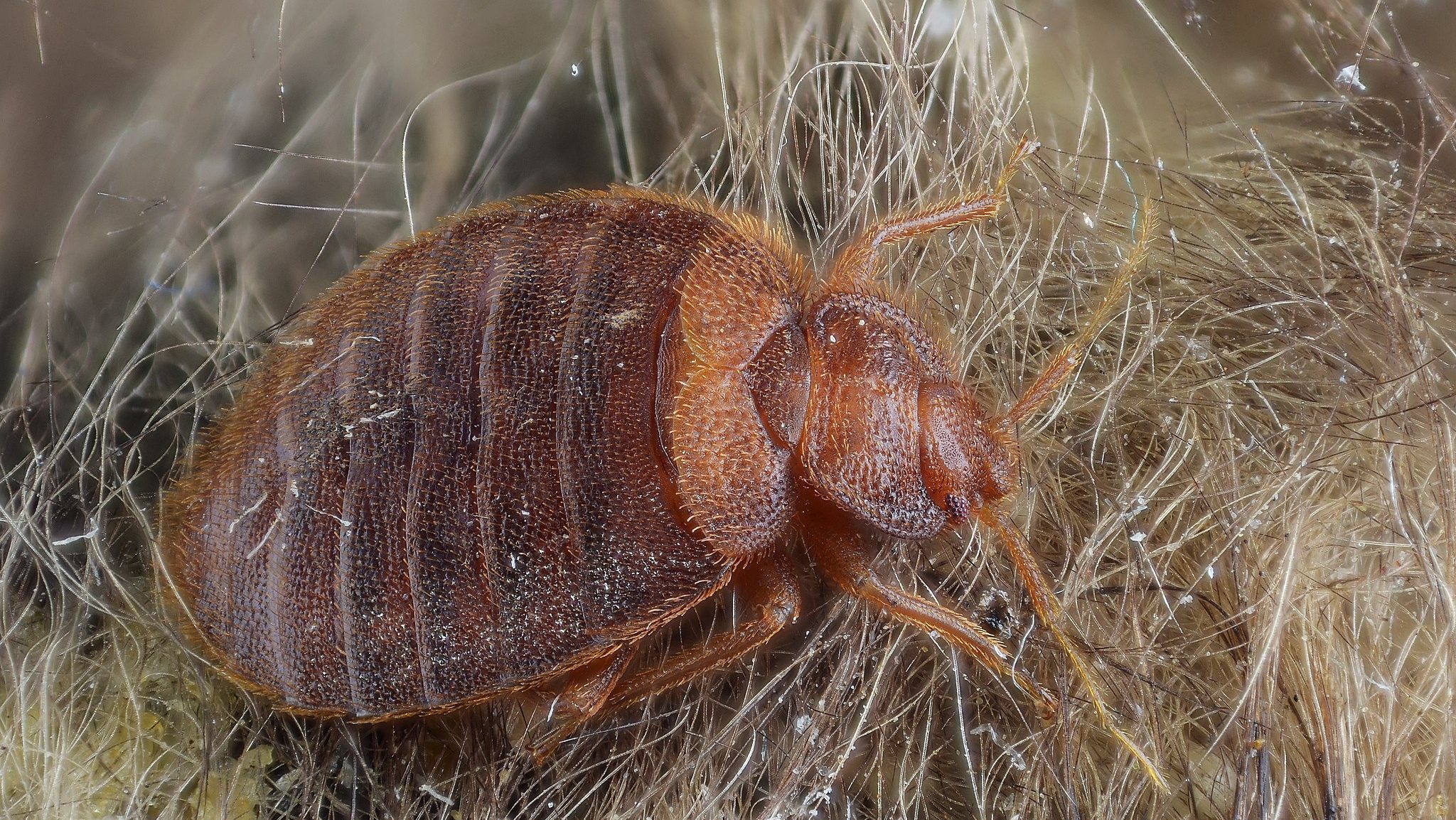 bed bug in hairs