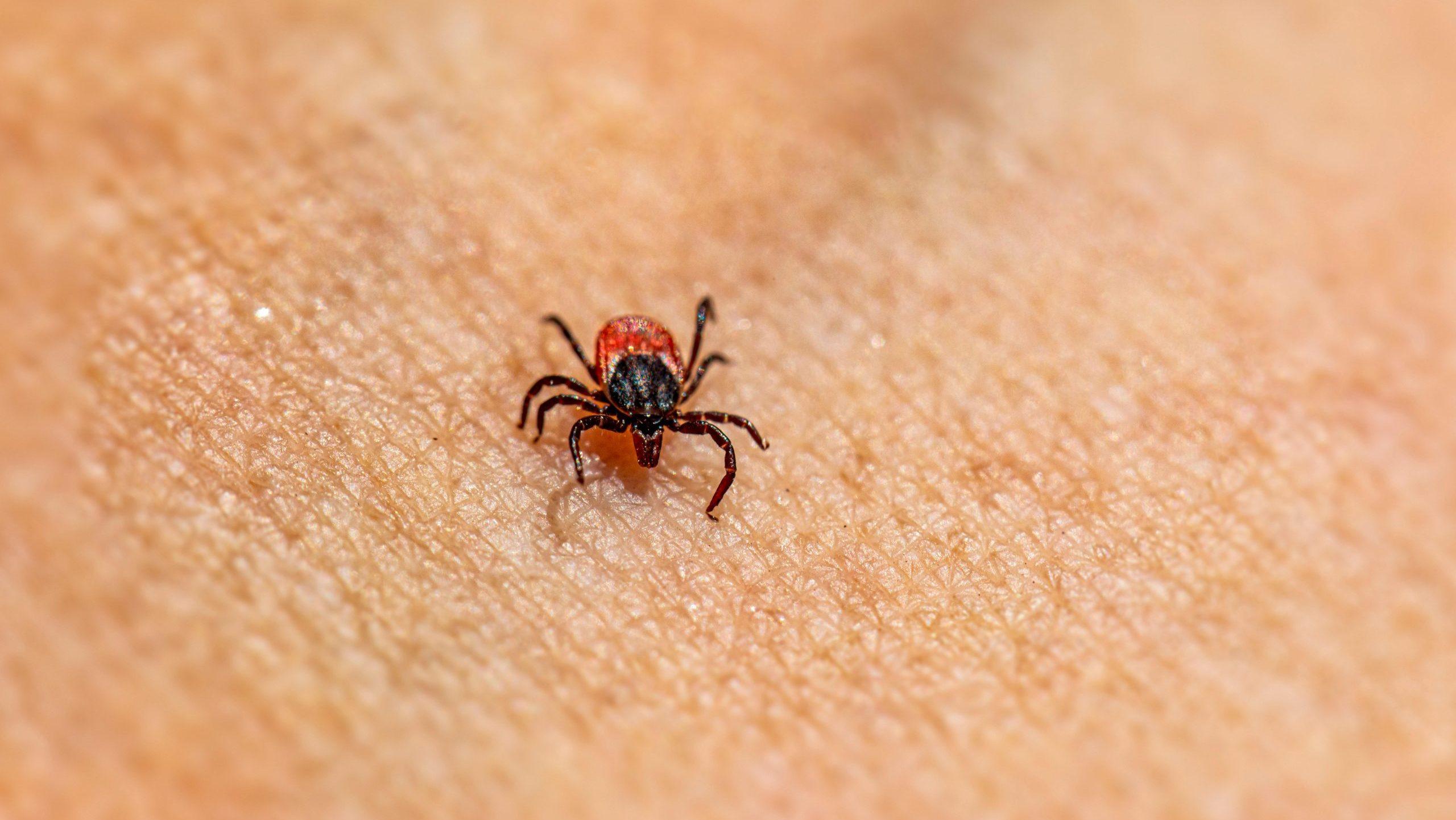 Ticks on Humans