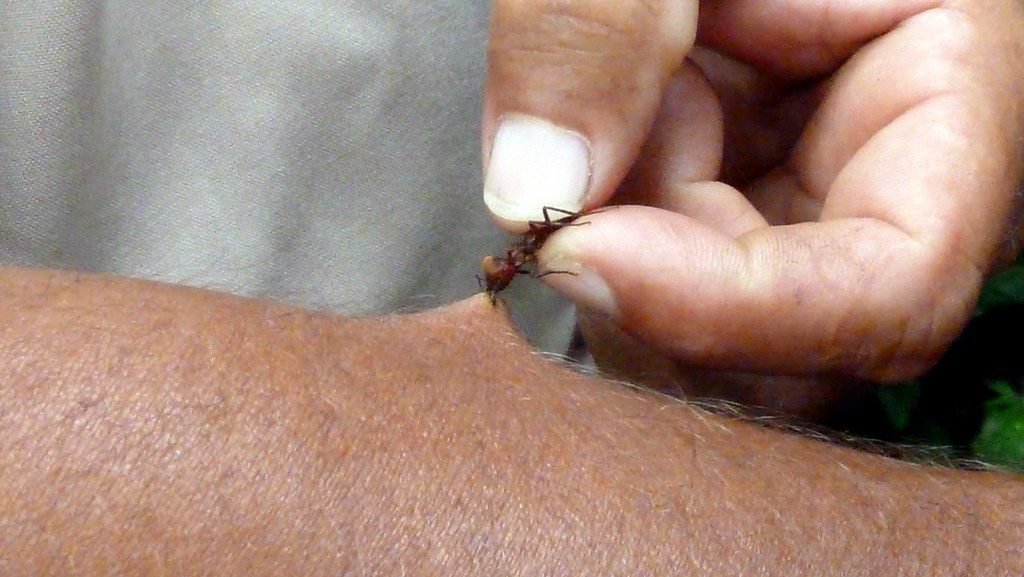 ant bites