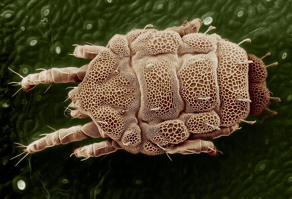 Scabies vs bedbugs