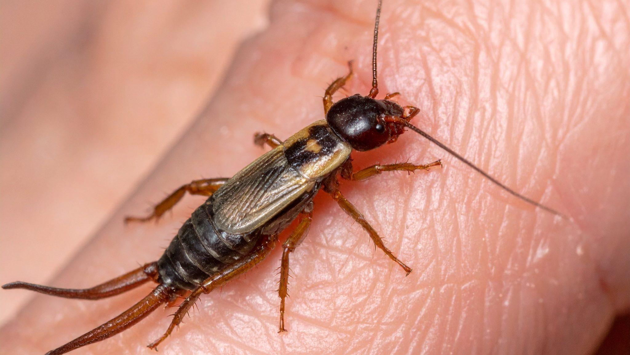 earwig biting human